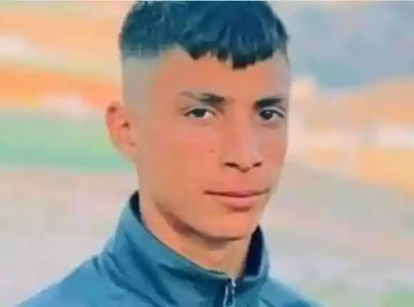 استشهاد فتى فلسطيني متأثرا بإصابته في نابلس