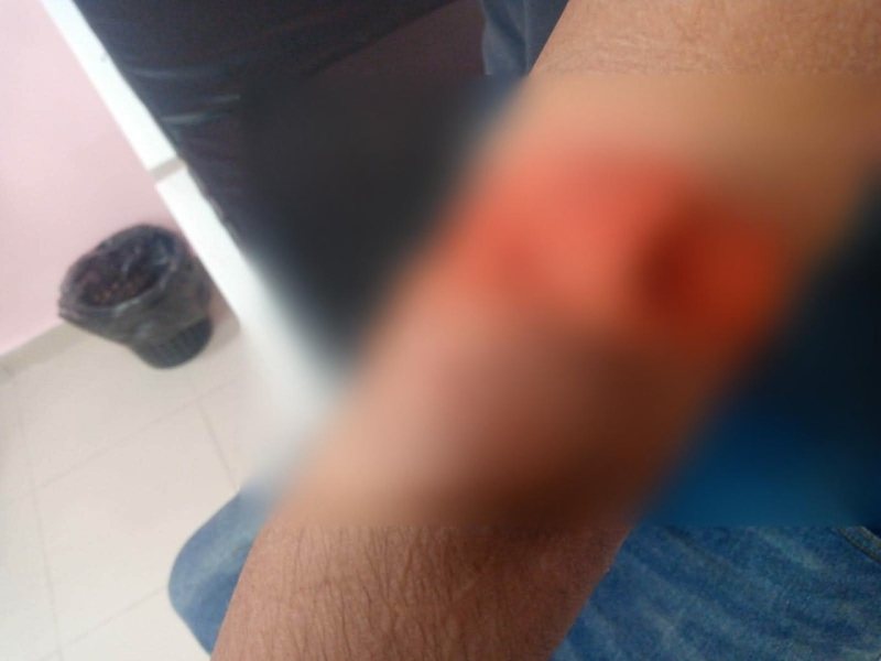 معناة مع الكلاب الضالة في الأغوار الشمالية.. 7 حالات عقر خلال شهر