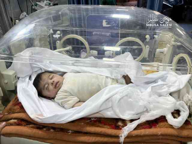 استشهاد الرضيعة الزبدة بسبب الجوع في مستشفى بشمال غزة - صور